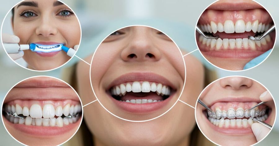 Cosmetic dentistry treatments overview